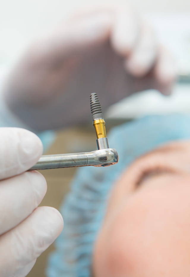 人気治療のご説明 インプラントの背景